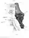 Fig. 13 - Anatomic external fixation system