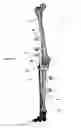 Fig. 16 - Anatomic external fixation system