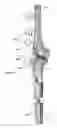 Fig. 17 - Anatomic external fixation system