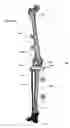 Fig. 20 - Anatomic external fixation system
