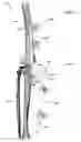 Fig. 22 - Anatomic external fixation system