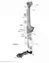 Fig. 25 - Anatomic external fixation system