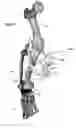 Fig. 29 - Anatomic external fixation system