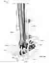 Fig. 33 - Anatomic external fixation system
