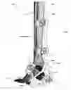 Fig. 34 - Anatomic external fixation system