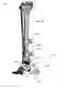 Fig. 37 - Anatomic external fixation system