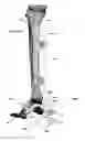 Fig. 41 - Anatomic external fixation system
