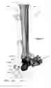 Fig. 43 - Anatomic external fixation system