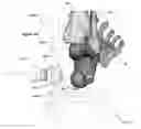 Fig. 44 - Anatomic external fixation system