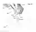 Fig. 45 - Anatomic external fixation system