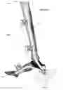 Fig. 49 - Anatomic external fixation system