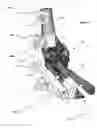 Fig. 02 - Anatomic external fixation system for the ankle