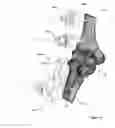 Fig. 03 - Anatomic external fixation system for the ankle