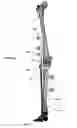 Fig. 16 - Anatomic external fixation system for the ankle