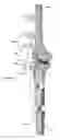 Fig. 17 - Anatomic external fixation system for the ankle