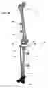 Fig. 20 - Anatomic external fixation system for the ankle