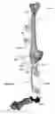 Fig. 25 - Anatomic external fixation system for the ankle
