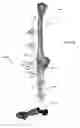 Fig. 28 - Anatomic external fixation system for the ankle