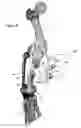 Fig. 29 - Anatomic external fixation system for the ankle