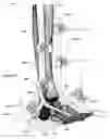 Fig. 32 - Anatomic external fixation system for the ankle