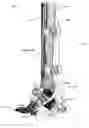 Fig. 34 - Anatomic external fixation system for the ankle