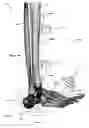 Fig. 35 - Anatomic external fixation system for the ankle