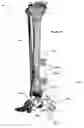 Fig. 37 - Anatomic external fixation system for the ankle