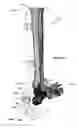 Fig. 43 - Anatomic external fixation system for the ankle