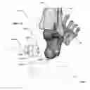 Fig. 44 - Anatomic external fixation system for the ankle