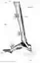 Fig. 49 - Anatomic external fixation system for the ankle