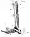 Fig. 52 - Anatomic external fixation system for the ankle