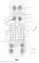 Fig. 02 - Spinal stabilizing and guiding fixation system