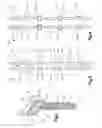 Fig. 03 - Spinal stabilizing and guiding fixation system