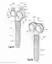 Fig. 07 - Spinal stabilizing and guiding fixation system