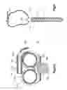 Fig. 08 - Spinal stabilizing and guiding fixation system