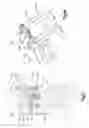 Fig. 16 - Spinal stabilizing and guiding fixation system