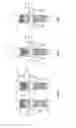 Fig. 03 - Spinal correction system and method
