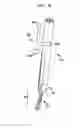 Fig. 22 - Methods and devices for polyaxial screw alignment
