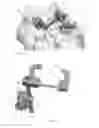 Fig. 07 - Orthopedic stabilization devices and methods for installation thereof