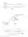 Fig. 04 - Bone Plate System and Related Methods