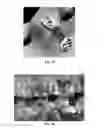 Fig. 07 - Bone Plate System and Related Methods