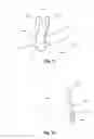 Fig. 15 - Bone Plate System and Related Methods