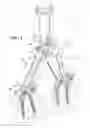 Fig. 02 - Osteotomy instrument