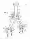 Fig. 03 - Osteotomy instrument