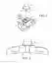 Fig. 03 - LOCKING MECHANISM FOR A CERVICAL FIXATION PLATE