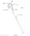 Fig. 14 - Cold plasma scalpel