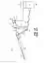Fig. 02 - Endometrial lining tissue treatment device