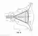 Fig. 07 - Endometrial lining tissue treatment device