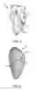 Fig. 04 - System and method for assessing effective delivery of ablation therapy