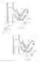 Fig. 31 - Catheter Apparatuses, Systems, and Methods for Renal Neuromodulation
